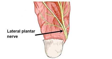 Medial Plantar Nerve Pain Causes