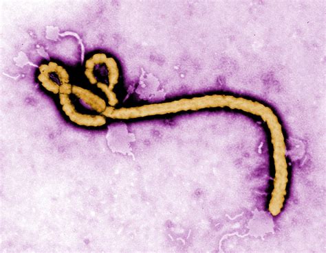 File:Ebola virus (2).jpg - Wikimedia Commons