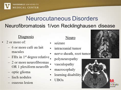 Neurocutaneous Disorders - Dr. Sarwar Jahan Bhuiyan