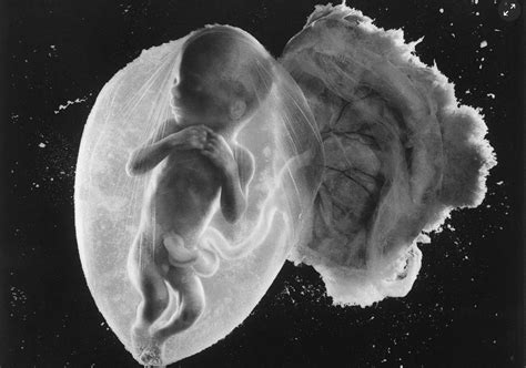 Amazing Image of Unborn Baby at 18 Weeks is Called the Photograph of the Century - LifeNews.com