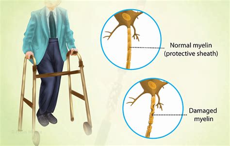 Health Symptoms : Causes, Treatment, Conditions and More