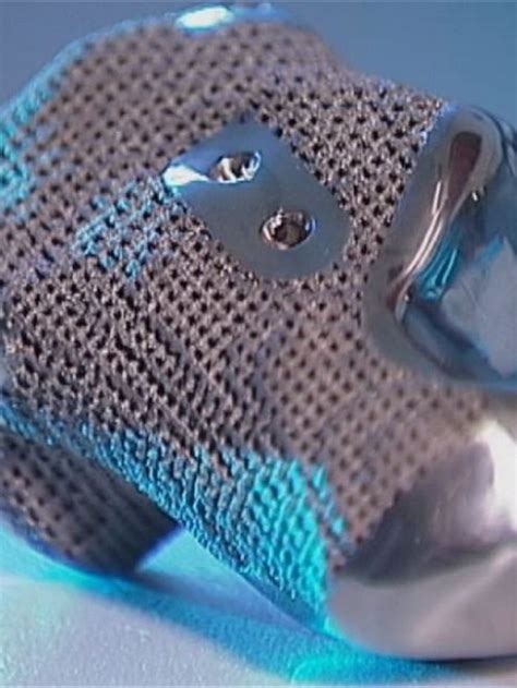 3D printed titanium heel - 3D printing raises ethical issues in medicine. 3D printing can offer ...