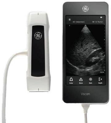 GE Vscan Extend – The Ultrasound Source