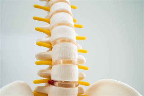 Sciatica: Causes, Symptoms, and How Acupuncture Can Provide Relief • Acupuncture Pain & Stress ...