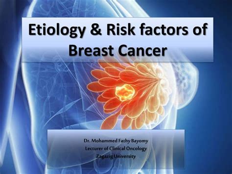 Etiology of breast cancer | PPT