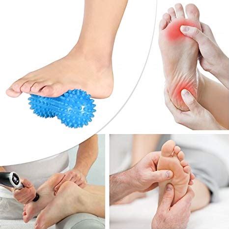 Treatment For Plantar Fasciitis - Foot Pain Explored