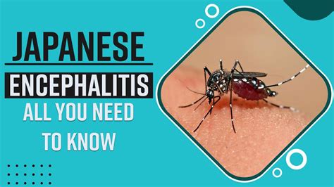 Japanese Encephalitis: Symptoms, Causes And Treatment, All You Need To ...