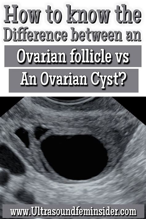 Ovarian Follicle vs an Ovarian Cyst? How to Tell the Difference ...