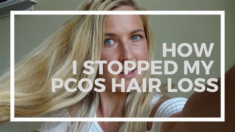 pcos hair loss during pregnancy - Bunny Keenan