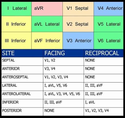 Reciprocal Changes in 12-Lead with Acute STEMI | EMTLIFE