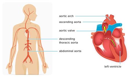 Ascending Aortic Aneurysm: Repair, Surgery, and Size Criteria