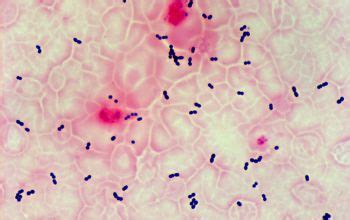 Enterococcus faecalis