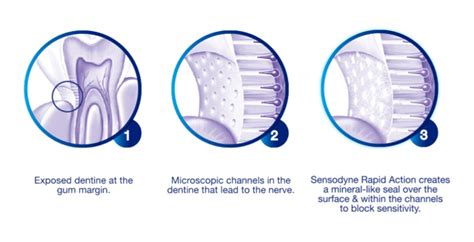 The Science Behind Rapid Action