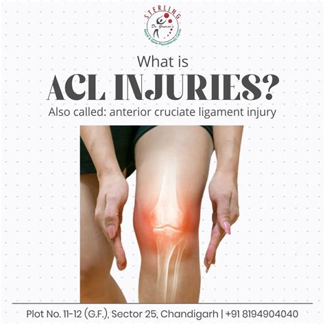 What is ACL Injuries? An ACL injury is a tear or sprain of the anterior ...