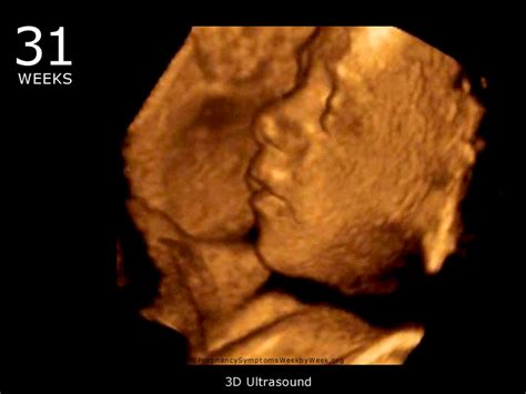 30 weeks pregnant 3d ultrasound - infobatman