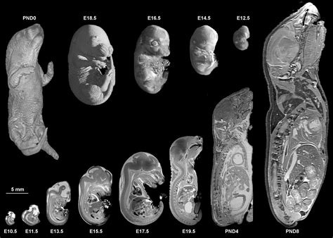 High-resolution magnetic resonance histology of the embryonic and neonatal mouse: A 4D atlas and ...