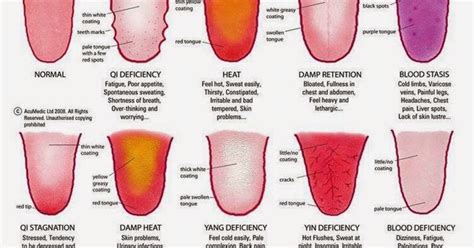 What does your tongue say about your state of health? - The Mind Awakened