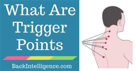 What Are Myofascial Trigger Points? (And 5 Ways To Release Them)