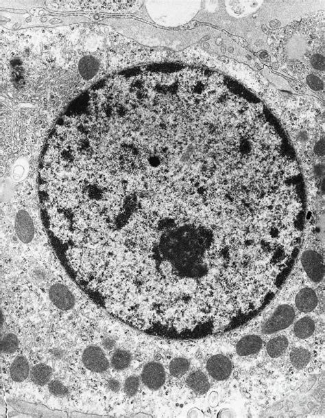 Nucleus, Tem Photograph by David M. Phillips