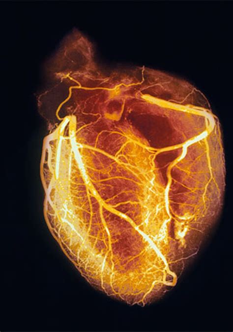 Cardiology Wallpapers - Wallpaper Cave