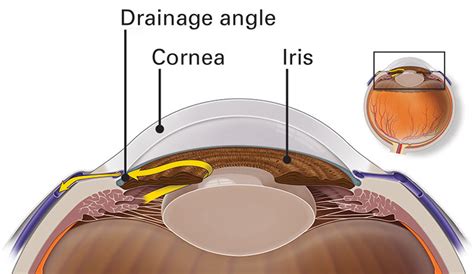 Intraocular pressure definition, normal range & intraocular pressure ...