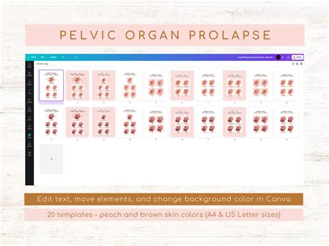 Types of Pelvic Organ Prolapse Rectocele Stages Cystocele Stages Uterine Prolapse Stages ...