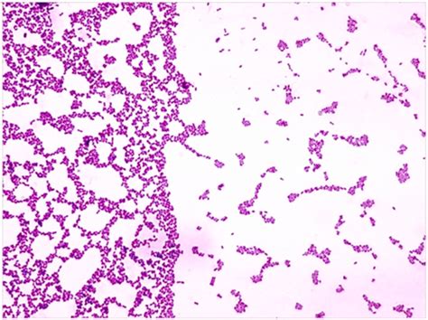 Streptococcus Mutans Under Microscope