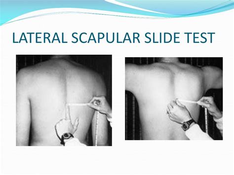 PPT - SCAPULAR DYSKINESIS & ITS RELATION TO SHOULDER PAIN PowerPoint Presentation - ID:375382