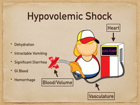 Cardiogenic Vs Hypovolemic Shock | Hot Sex Picture