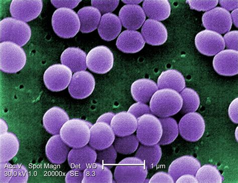 File:Staphylococcus aureus VISA 2.jpg - Wikipedia