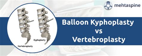 Kyphoplasty and Vertebroplasty | Mehta Spine