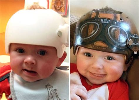 Artist Transforms Babies’ Head-Shaping Helmets Into Beautiful Art | Blogs and Websites ...