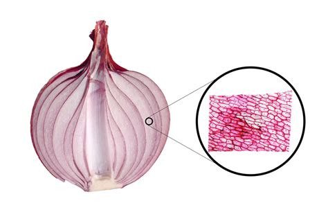 Onion peel experiment — task. Science CBSE, Class 9.