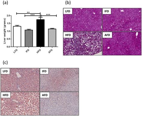 (a) Liver weight, (b) PAS staining of the liver, and (c) Oil Red O... | Download Scientific Diagram