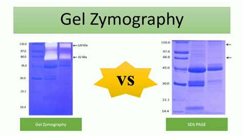 Gel zymography | protein gel electrophoresis -5 - YouTube