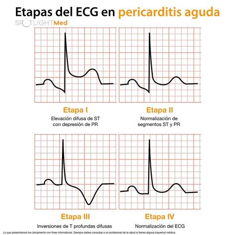 Pin em Pasión médica