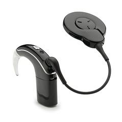 Cochlear Implant Options | Pacific Hearing Services