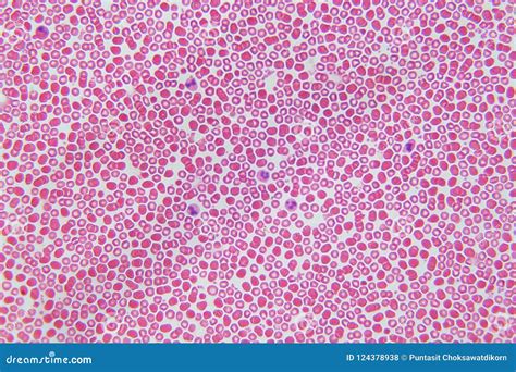 Blood Cells Under Microscope View for Education Stock Photo - Image of cancer, blood: 124378938