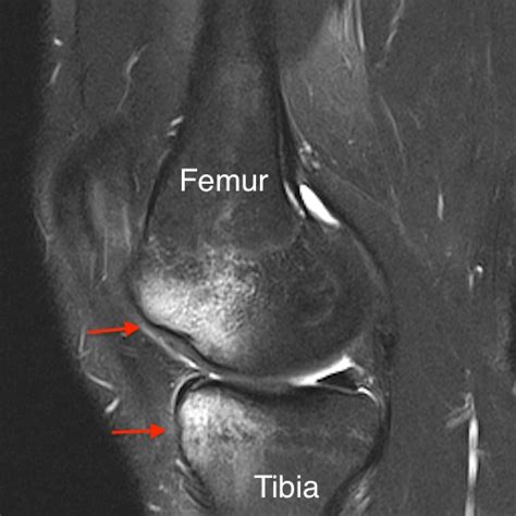 The Telltale Bone | Neighborhood Radiologist