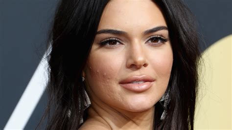 Kendall Jenner Says Suffering From Acne Was 'Debilitating' For Her | Allure