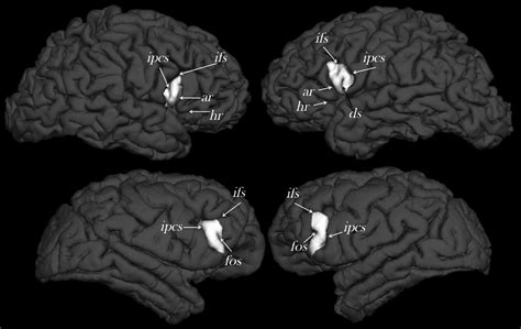 A Comparative Magnetic Resonance Imaging Study of the Anatomy ...