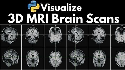 Neuroimaging: Visualize 3D MRI Brain Scans with Python