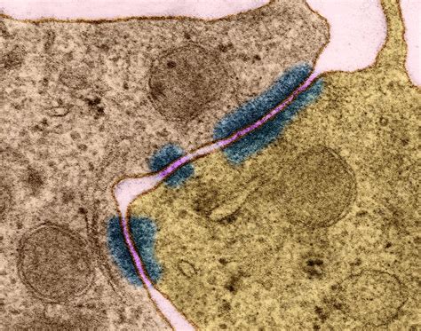 Epithelial cell Zonula adherens, TEM - Stock Image - C031/9714 ...