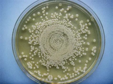 Mueller Hinton Agar (MHA) - Preparation, Composition and Uses - Laboratoryinfo.com