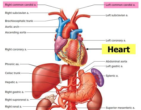 Carotid artery disease - Stenosis, Carotid Artery Dissection