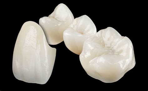 Are zirconia crowns the right choice?