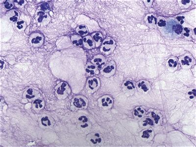 Canine Chronic Bronchitis: A Review and Update | Today's Veterinary Practice