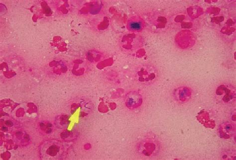 Clostridium septicum obtained from intarabdominal free fluid (dry... | Download Scientific Diagram