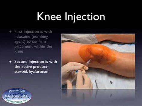 Can Cortisone Injection Help Knee Pain - Stéroïde Légale