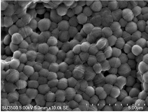 Scanning electron micrograph of Pediococcus acidilactici MK20 growth on... | Download Scientific ...